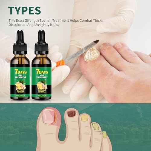 Ginger nail treatment 7 days nail support nail care, 2 pcs nail treatment, Ginger nail growth serum, Ginger cuticle care oil for nails,Cuticle serum for nails