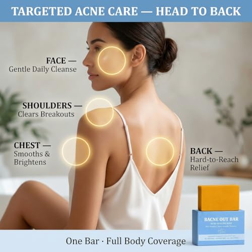 Turmeric Acne Soap Bar – Back, Face & Chest Cleanser