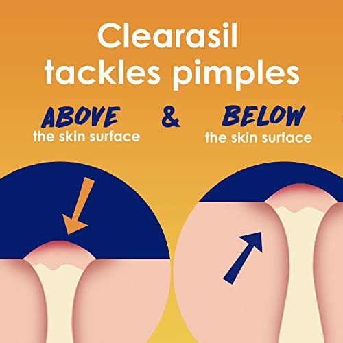 Clearasil Stubborn Acne Control 5in1 Daily Facial Cleansing Pads, with Salicylic Acid Acne Treatment Medicine, 90 Count (Pack of 2)
