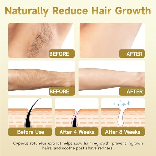 Cyperus Rotundus Oil - Natural Hair Removal & Inhibition Oil