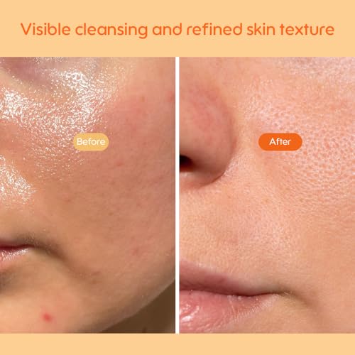 Kiero Refining Enzyme Cleanser - Foaming Enzyme Powder Face Wash with Papaya Enzymes, Chia Seeds & Beta-Glucan - Vegan Facial Cleanser with Gentle Exfoliation for Pore Buildup & Impurities (1.76 oz)