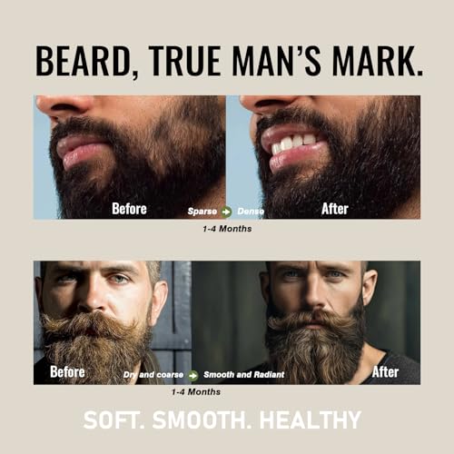 Biotin Beard Oil for Men Set ? 2 Pack Unscented & Sandalwood Beard Oil Blended with Castor & Grape Seed Oil for Thicker, Softer, Moisturizing Beard ? Gift for Father, Husband, Boyfriend ? 4 oz