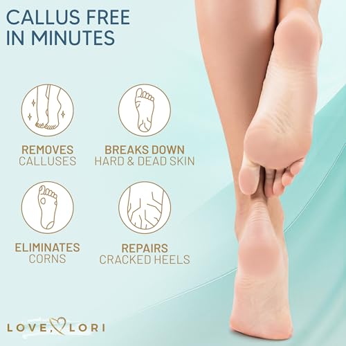 Love Lori Callus Remover Gel Extra Strength Pedicure Tool for Feet 6oz