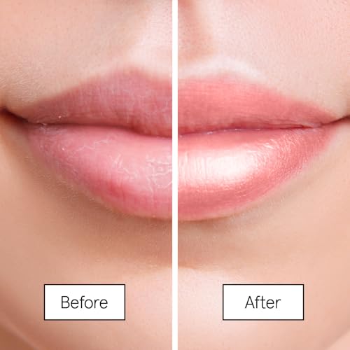 grace & stella Award Winning Lip Butter - Lip Balm Hydrating - Nourishing Lip Mask (3-pack) Airplane Travel Essentials, Beach Vacation and Purse Essentials - Lip Moisturizer for Dry Lips - Vegan
