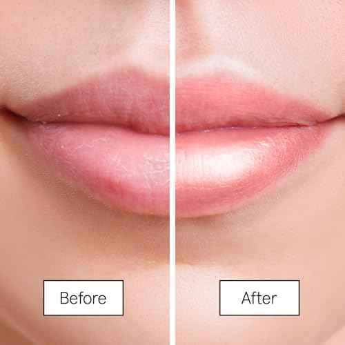 grace & stella Award Winning Lip Butter - Lip Balm Hydrating - Nourishing Lip Mask (3-pack) Airplane Travel Essentials, Beach Vacation and Purse Essentials - Lip Moisturizer for Dry Lips - Vegan