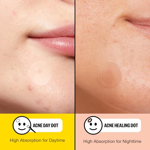 PEACE OUT Acne Day & Night Duo, Invisible Acne Patches for Day + Healing Overnight Acne Treatment, Clear Blemishes Fast with 2% Salicylic Acid, Retinol & Aloe Vera, 20 Dots