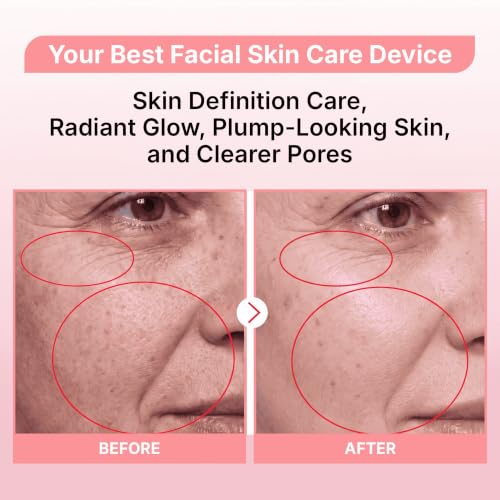 Microcurrent Red Light Facial Glow Wand | Face & Neck