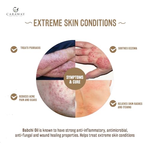 CARAWAY BAKUCHI OIL - Supercritical CO2 Extract| Pure Babchi Oil for Skin, Pigmentation, Vitiligo & Uneven skin tone| Bakuchi Seed Oil ? 50ml