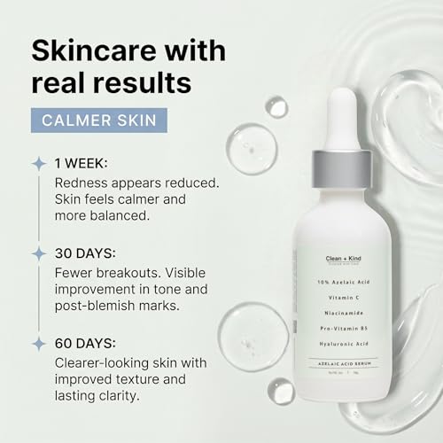 Azelaic Acid Serum with Niacinamide & Vitamin C ? Brightens Dark Spots, Reduces Redness, Helps Clear Acne Marks, Calms Sensitive Skin ? Lightweight Facial Serum