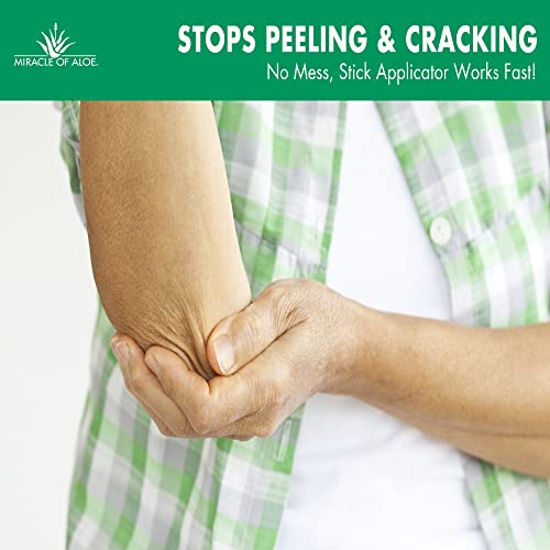 Miracle Knee & Elbow Stick with UltraAloe Gel for Dry, Cracked Skin, Soothes, Moisturizes, Promotes Healing, 2.5 oz