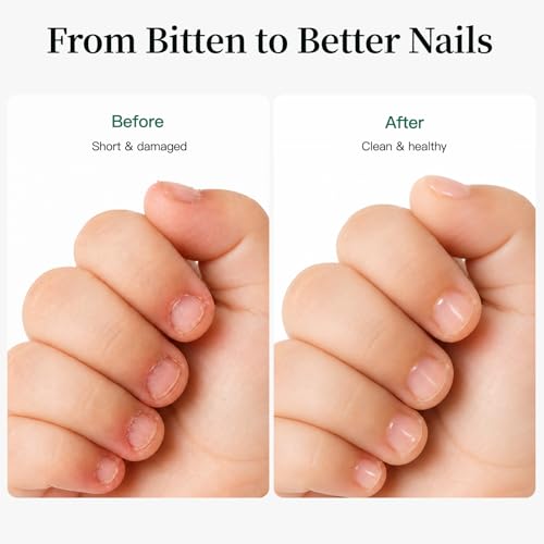 APUREE Nail Biting Prevention for Kids – Safe Bitter Deterrent with Habit Tracker