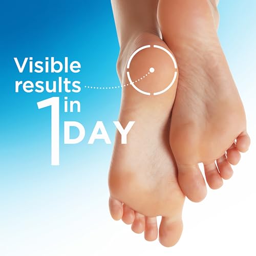 Flexitol Heel Balm - Cracked Heel Cream with 25% Urea, 4 oz