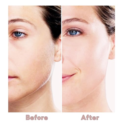 Painless Facial Hair Remover for Women - Rechargeable, Rose Gold, Portable with 2 Replacement Heads