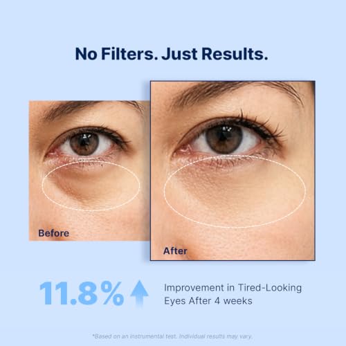 Enaskin Naturals Blue Under Eye Patches for Dark Circles & Puffiness - 60 Patches
