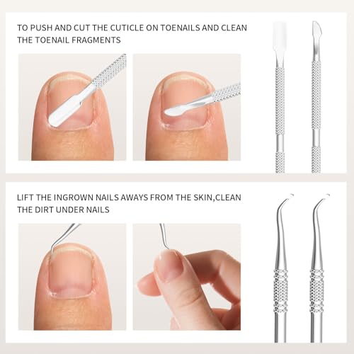 7-Piece Ingrown Toenail Removal Kit - Stainless Steel Pedicure Tools