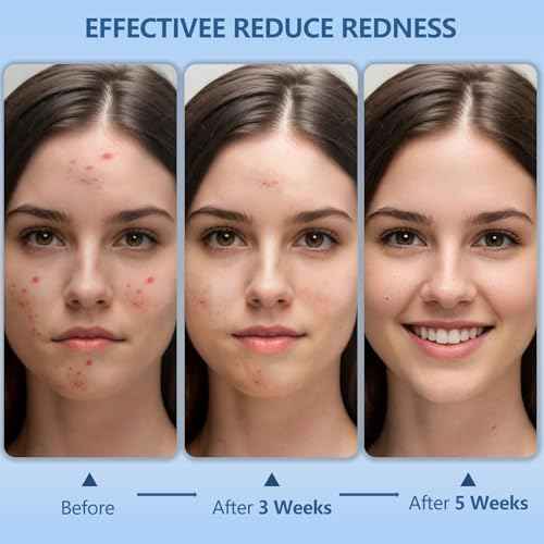 Disposable Face Towels, 12"¡¿12" Extra Large Face Towelettes, Ultra Soft Facial Towels for Sensitive Skin, Makeup Remover Dry Wipes, 55 Count (1 Pack)