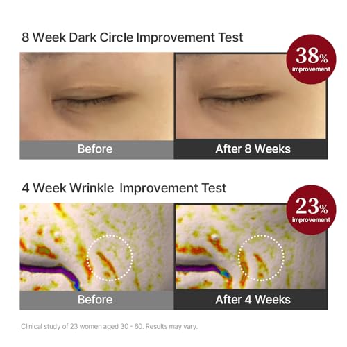 SWANICOCO Pregnancy Safe Fermentation Peptine Eye Care Cream Under Eye Cream with 8 Peptides and Niacinamide, Anti Aging Eye Cream for Wrinkles & Crows Feet Korean Skincare 20ml 0.68 Fl Oz