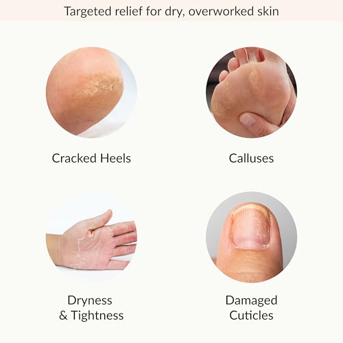 Epielle Hydrating Hand & Foot Masks - 6 Gloves & 6 Socks Spa Kit