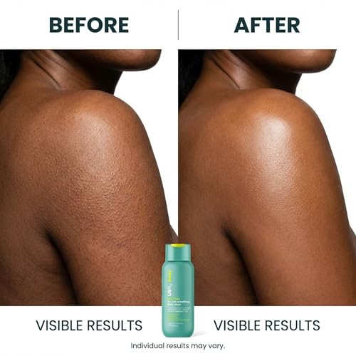 Urban Skin Rx¢ç Even Tone 5% AHA Smoothing Body Wash, Lathering Gel Formula, Deeply Cleanses, Soothes & Improves Appearance of Bumpy Texture, Blemishes & Uneven Skin Complexion, Daily Use, 13 Fl Oz