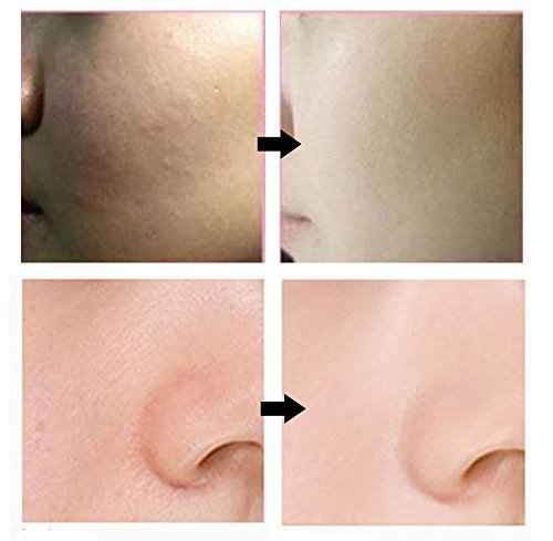 Bergamo] Magic Snail BB Cream 50ml /Intense Care Wrinkle Care Sunblock/Korean Cosmetics