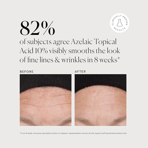 Naturium Azelaic Topical Acid 10% Jumbo, Face & Skin Care Beauty Treatment with Niacinamide & Vitamin C, 2 oz