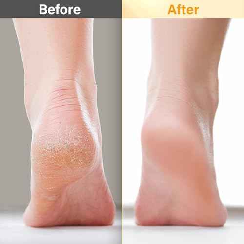 Pedicure Kit For Feet 5pcs Foot Spa Set For Christmas Birthday Valentine's Mother's Day Women Wife Girlfriend Gift Rose Lavender Foot Soak Salt Foot Callus Remover Gel Foot Rasp Foot Cream Foot Care