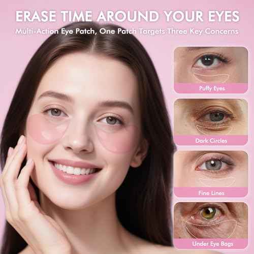 Under Eyes Patches, 40 Pairs Rose Hydrogel Eye Mask for Puffy Eyes and Dark Circles with Rose Essence, Hyaluronic Acid & Niacinamide, Deep Hydrating Eye Treatment for Men & Women