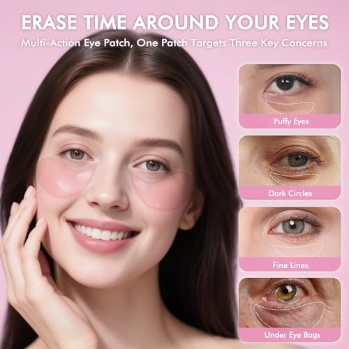 Under Eyes Patches, 40 Pairs Rose Hydrogel Eye Mask for Puffy Eyes and Dark Circles with Rose Essence, Hyaluronic Acid & Niacinamide, Deep Hydrating Eye Treatment for Men & Women