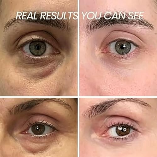 Korean Collagen Under Eye Balm – 0.35oz Hydrating Glow Stick