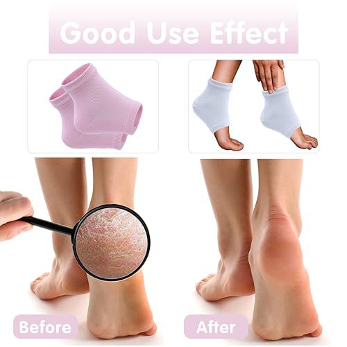 Moisturizing Heel Socks for Dry Cracked Feet - 2 Pairs