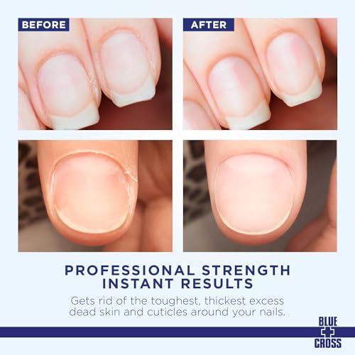Blue Cross Cuticle Remover Cream for Dry Damaged Nails - 2oz, Made in USA