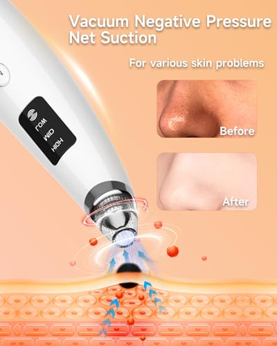 Blackhead Remover Vacuum Pore Cleaner with 6 Probes