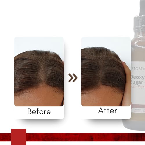Ketostat 2-Deoxy-D-Ribose Scalp Gel 110ml | Topical Formula
