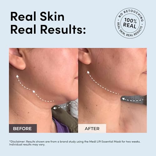Medi Lift EMS Facial Toning Device - Hands-Free Face Mask