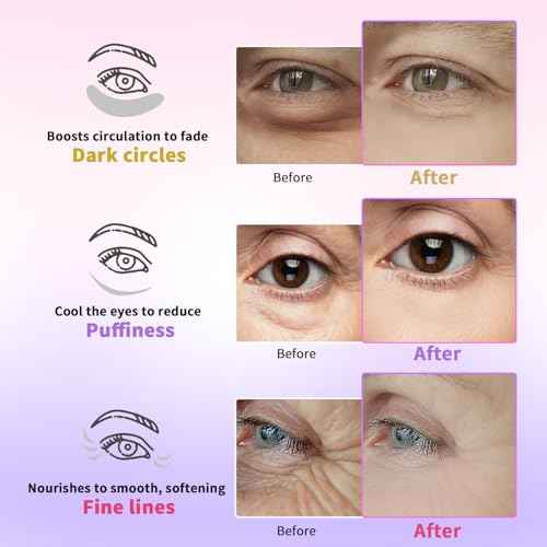 Under Eye Patches for Dark Circles, Puffiness, Fine Lines, Eye Mask Set with Retinol, 24K Gold, Caffeine, Gel Mask for Birthday & Spa Party Favors, Skincare Gift for Women & Men, 24 Pairs