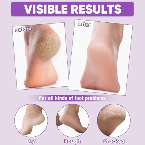 TEAWOO Moisturizing Foot Mask Socks with Lavender & Jojoba Oil - 8 Pairs
