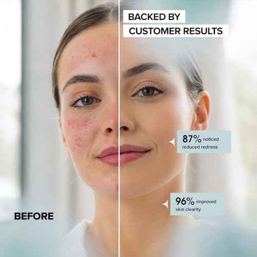 Face Towels - Ultra Soft and Thick Disposable Face Towelettes for Women - Biodegradable Facial Towels for Sensitive Skin - Face Cleansing, Makeup Removal, 10x12 Extra Large - 50 Pack