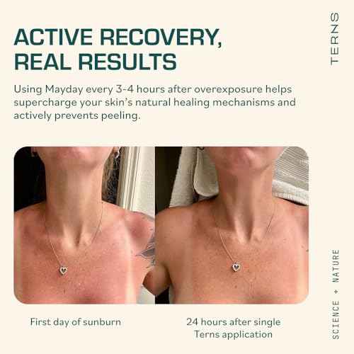 TERNS Mayday Intense After Sun Gel Cream ? Fast-Acting Sunburn Recovery with Marine Ingredients ? Cooling, Dermatologist Approved Skin Relief and Repair, Fragrance Free 2 oz