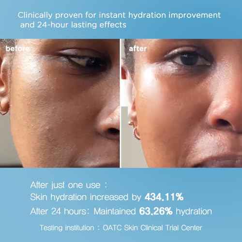 Nightingale Ecto-Hyaluronic Toner with 8 Layer Hyaluronic Acid, Ectoin, Hydrating for Dry Skin, Korean Toner, Alcohol Free, Fragrance Free, Hypoallergenic, Cruelty Free, Vegan, Korean Skin Care