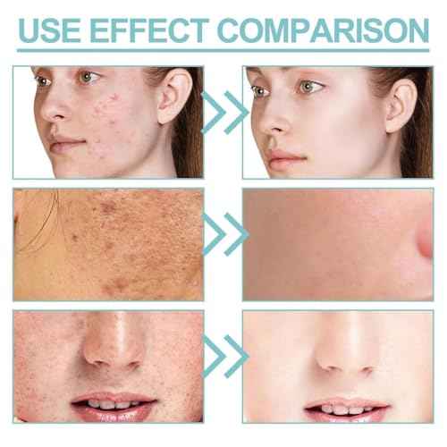 Milky Gluta White Soap, 70g Glutamilk ?????????????????? Soap, Milky Gluta White Soap20x, Gluta Milk Barsoap for Face & Body, For Firm & Brightening Skin, Deep Cleans (5pcs)