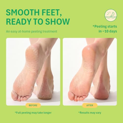 Purederm Foot Peel Mask for Dry, Cracked Heels – Exfoliating Treatment (3 Pairs)