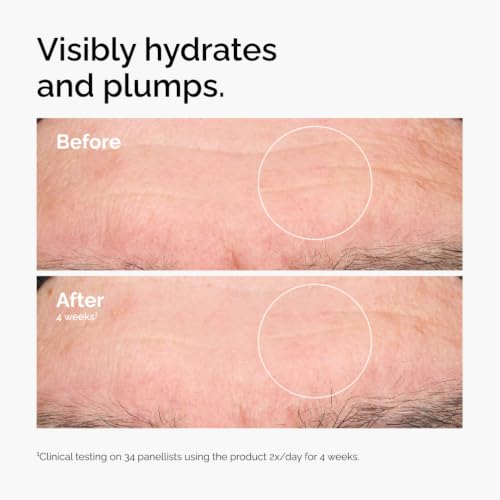 The Ordinary Hyaluronic Acid 2% + B5 Serum for Deep Hydration & Skin Plumping