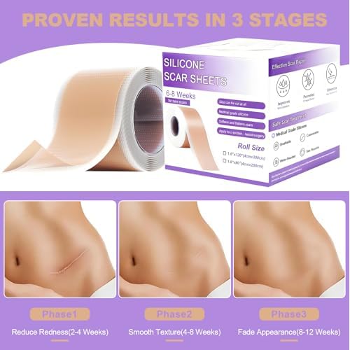WZPB Silicone Scar Sheets for Scar Removal - Medical Grade Scar Tape for Surgical Scars, C-Section, Keloid, Hypertrophic & Acne Scars | 1.5" x 120" Reusable & Waterproof Scar Strips Roll (2 Pack)