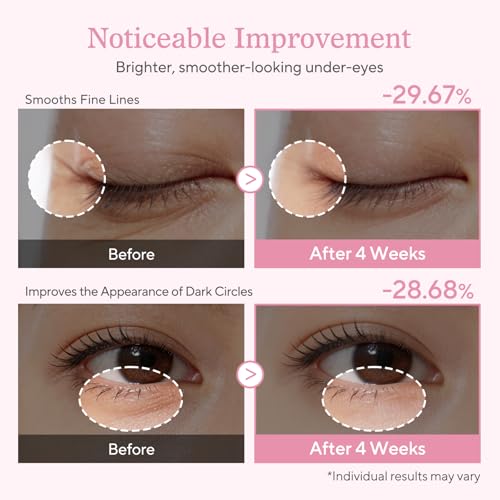 ALVESTRA Under Eye Cream with PDRN & Retinol, Dark Circles & Wrinkles