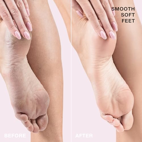 STARSKIN Fab Feet Fast, Instant Foot Peeling Spray, Foot File & Foot Cream for Soft & Smooth Skin, Premium Callus Remover for Rough Cracked & Dry Feet