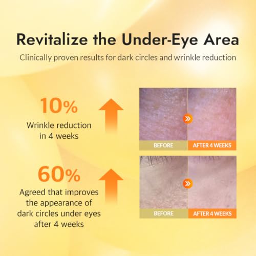 MIZON 24K Gold Under Eye Patches, 60 Pcs – Snail Mucin & Collagen