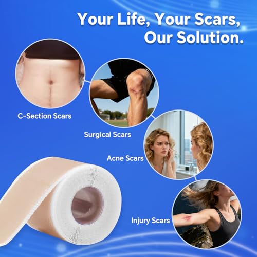 Professional Silicone Scar Sheets, Silicone Scar Tape, Silicone Scar Patch, Reusable Scar Silicone Strips (1.5M)