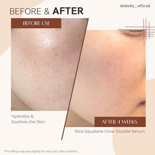 Rice Squalane Glow Double Serum ? Korean Hydrating Serum with Olive Squalane 5%, Rice Extract ? Glass Skin, Anti-Pigmentation, Even Skin Tone, 50ml / 1.69 Fl.oz