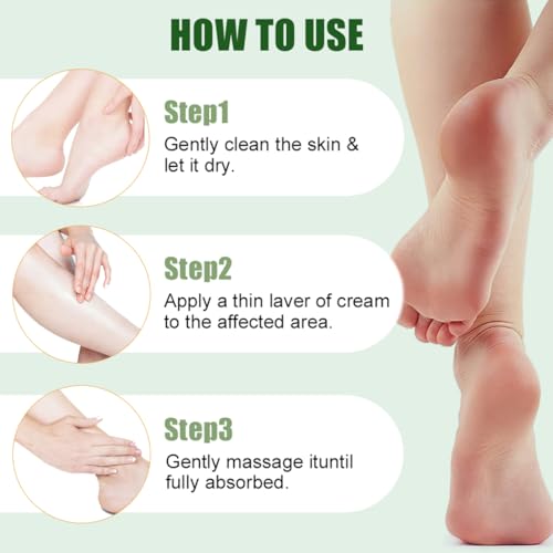 60% Urea Foot Cream for Cracked Heels with Salicylic Acid