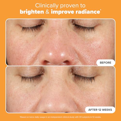 Paula's Choice BOOST C15 Super Booster, 15% Vitamin C Serum for Face, Face Serum with Vitamin E & Ferulic Acid for Discoloration & Glow, Fragrance-Free